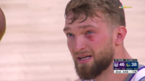 Sabonis vėl liko sužeistas, tačiau „Kings“ išlygino serijos rezultatą