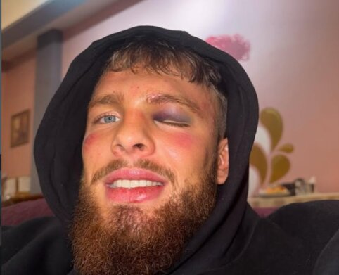 Sužalotas, bet nenugalėtas: D. Dirkstys Latvijoje pasiekė pergalę prieš boksininką