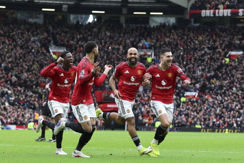 &bdquo;Man Utd&ldquo; žaidėjai kaltina televizijos kameras dėl prasto pasirodymo